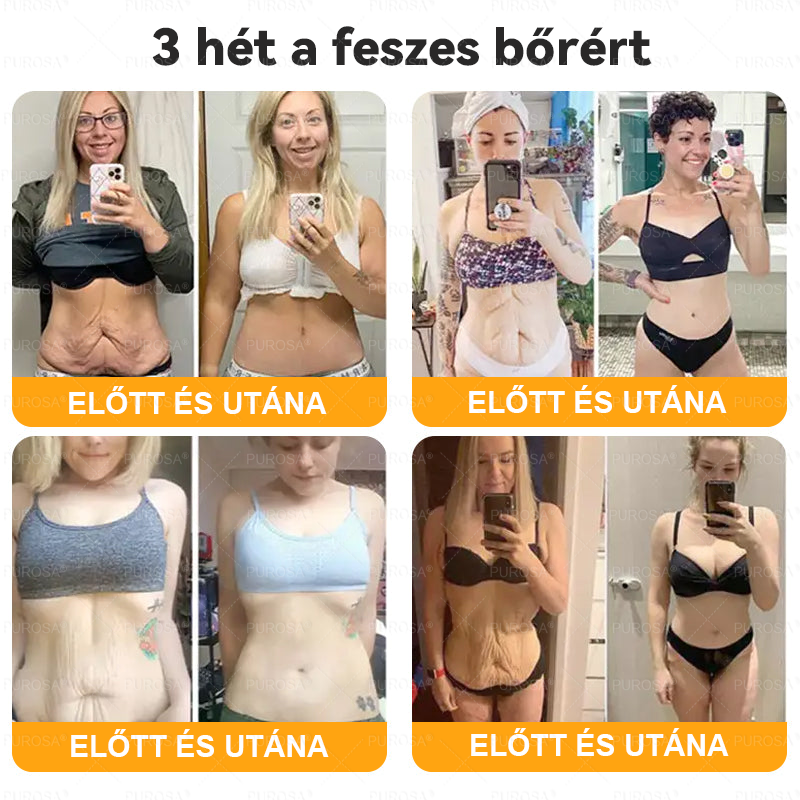 𝐌𝐚𝐠𝐲𝐚𝐫𝐨𝐫𝐬𝐳á𝐠𝐫ó𝐥 𝒌é𝒔𝒛ü𝒍𝒕 é𝒔 𝘀𝘇á𝗹𝗹í𝘁𝗼𝘁𝘁✨🌿𝐏𝐔𝑹𝑶𝙎𝘼® 𝑴é𝒉𝒎é𝒓𝒆𝒈 𝐁ő𝐫𝐟𝐞𝐥ú𝐣í𝐭ó 𝗞𝗿é𝗺 🔥𝐔𝐓𝐎𝐋𝐒Ó 𝑵𝑨𝑷 – 𝟴𝟬% 𝙆𝙀𝘿𝙑𝙀𝙕𝙈É𝙉𝙔🔥