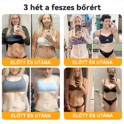 𝐌𝐚𝐠𝐲𝐚𝐫𝐨𝐫𝐬𝐳á𝐠𝐫ó𝐥 𝒌é𝒔𝒛ü𝒍𝒕 é𝒔 𝘀𝘇á𝗹𝗹í𝘁𝗼𝘁𝘁✨🌿𝐏𝐔𝑹𝑶𝙎𝘼® 𝑴é𝒉𝒎é𝒓𝒆𝒈 𝐁ő𝐫𝐟𝐞𝐥ú𝐣í𝐭ó 𝗞𝗿é𝗺 🔥𝐔𝐓𝐎𝐋𝐒Ó 𝑵𝑨𝑷 – 𝟴𝟬% 𝙆𝙀𝘿𝙑𝙀𝙕𝙈É𝙉𝙔🔥