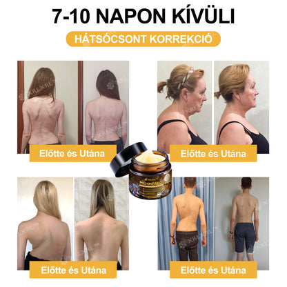 Hivatalos bolt: XRLXRL® Méhméreg Azonnali Ultra Erős Fájdalomcsillapító Krém - (Enyhíti a fájdalmat ízületi gyulladás, izomfájdalom, hátfájás, térdek, hát, vállak, csípők, csuklók, kezek esetén)
