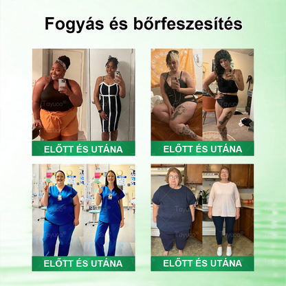Hivatalos Webáruház | ✨✨ 𝐓𝙖𝙮𝒖𝙤𝙤®  𝗠𝗼𝗿𝗶𝗻𝗴𝗮 · 𝑩𝒆𝒓𝒃𝒆𝒓𝒊𝒏𝒆 × 𝗡𝗔𝗗 𝗞𝗮𝗿𝗰𝘀ú𝘀í𝘁ó é𝙨 𝒃é𝒍𝒓𝒆𝒏𝒅𝒔𝒛𝒆𝒓𝒊 𝐞𝐠é𝐬𝐳𝐬é𝐠𝐞𝐭 𝒆𝒍ő𝒔𝒆𝒈í𝒕ő 𝙣𝙖𝙣𝙤 𝗺𝗶𝗸𝗿𝗼𝘁ű𝘀 𝒕𝒂𝒑𝒂𝒔𝒛 🇭🇺  (Naponta csak egyszer — az első látható változások már 7 nap után) ✅  Átfogó támogatás az alakformáláshoz