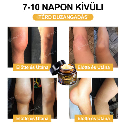 Hivatalos bolt: XRLXRL® Méhméreg Azonnali Ultra Erős Fájdalomcsillapító Krém - (Enyhíti a fájdalmat ízületi gyulladás, izomfájdalom, hátfájás, térdek, hát, vállak, csípők, csuklók, kezek esetén)