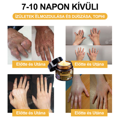 Hivatalos bolt: XRLXRL® Méhméreg Azonnali Ultra Erős Fájdalomcsillapító Krém - (Enyhíti a fájdalmat ízületi gyulladás, izomfájdalom, hátfájás, térdek, hát, vállak, csípők, csuklók, kezek esetén)