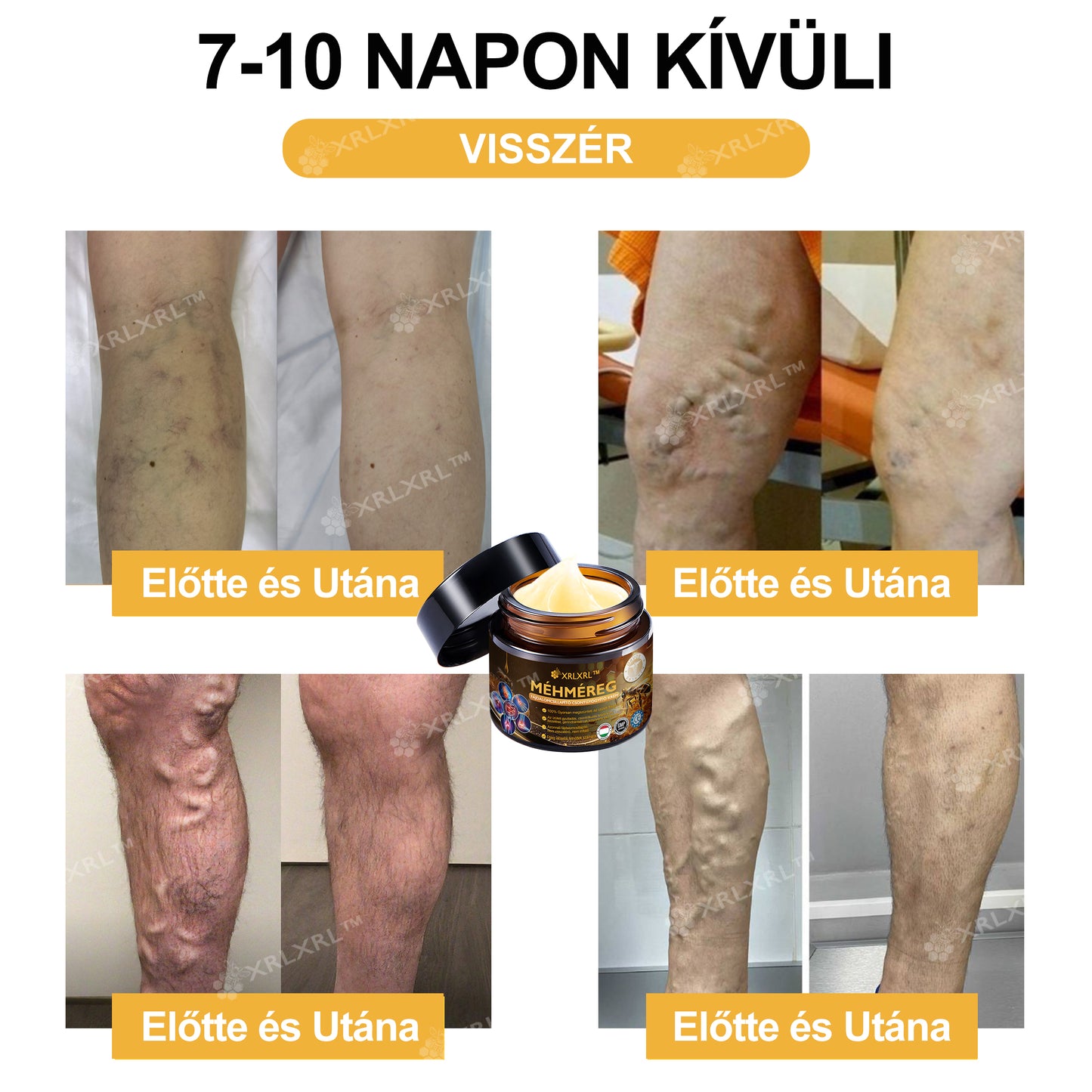 Hivatalos bolt: XRLXRL® Méhméreg Azonnali Ultra Erős Fájdalomcsillapító Krém - (Enyhíti a fájdalmat ízületi gyulladás, izomfájdalom, hátfájás, térdek, hát, vállak, csípők, csuklók, kezek esetén)