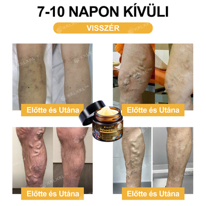 Hivatalos bolt: XRLXRL® Méhméreg Azonnali Ultra Erős Fájdalomcsillapító Krém - (Enyhíti a fájdalmat ízületi gyulladás, izomfájdalom, hátfájás, térdek, hát, vállak, csípők, csuklók, kezek esetén)