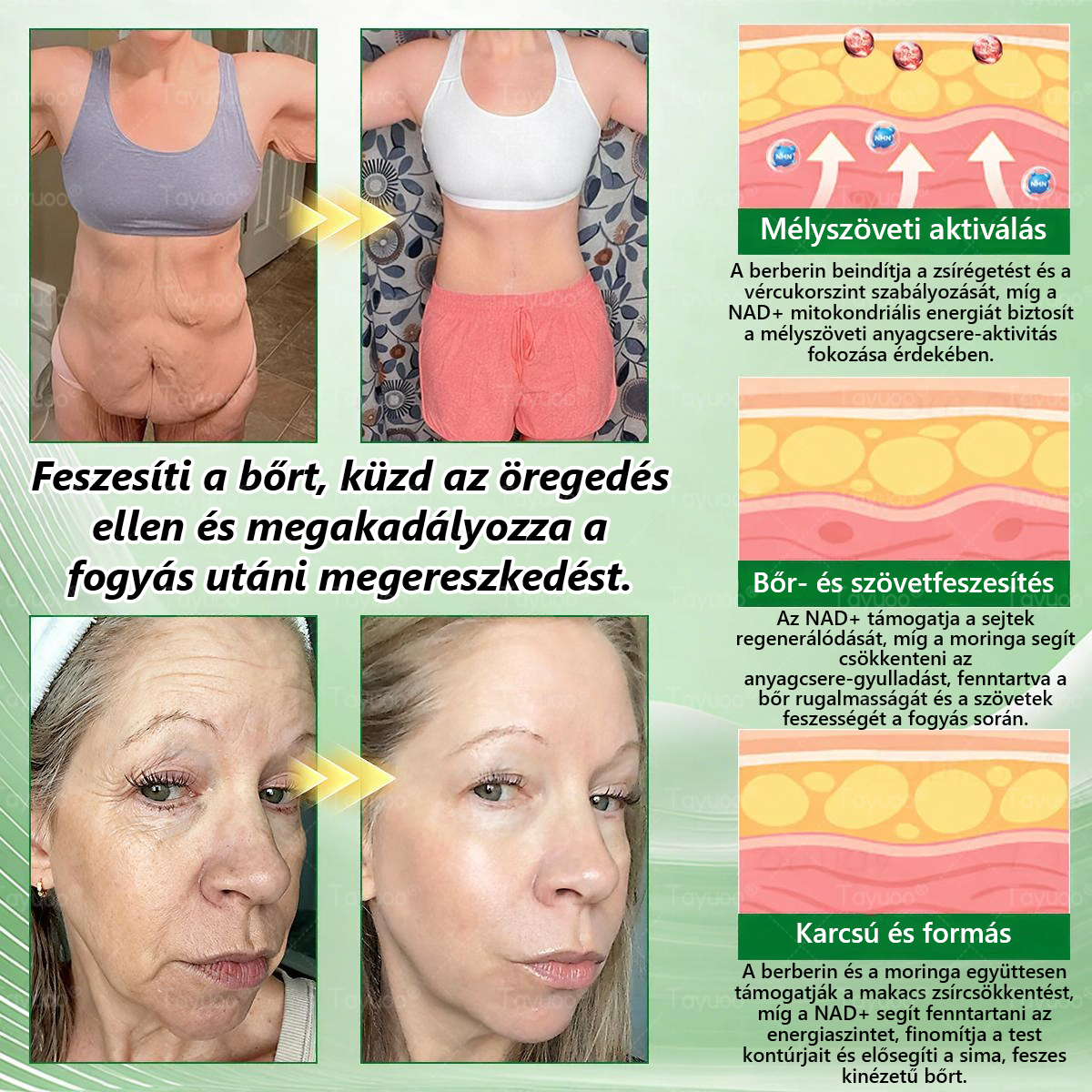 Hivatalos Webáruház | ✨✨ 𝐓𝙖𝙮𝒖𝙤𝙤®  𝗠𝗼𝗿𝗶𝗻𝗴𝗮 · 𝑩𝒆𝒓𝒃𝒆𝒓𝒊𝒏𝒆 × 𝗡𝗔𝗗 𝗞𝗮𝗿𝗰𝘀ú𝘀í𝘁ó é𝙨 𝒃é𝒍𝒓𝒆𝒏𝒅𝒔𝒛𝒆𝒓𝒊 𝐞𝐠é𝐬𝐳𝐬é𝐠𝐞𝐭 𝒆𝒍ő𝒔𝒆𝒈í𝒕ő 𝙣𝙖𝙣𝙤 𝗺𝗶𝗸𝗿𝗼𝘁ű𝘀 𝒕𝒂𝒑𝒂𝒔𝒛 🇭🇺  (Naponta csak egyszer — az első látható változások már 7 nap után) ✅  Átfogó támogatás az alakformáláshoz