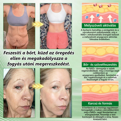 Hivatalos Webáruház | ✨✨ 𝐓𝙖𝙮𝒖𝙤𝙤®  𝗠𝗼𝗿𝗶𝗻𝗴𝗮 · 𝑩𝒆𝒓𝒃𝒆𝒓𝒊𝒏𝒆 × 𝗡𝗔𝗗 𝗞𝗮𝗿𝗰𝘀ú𝘀í𝘁ó é𝙨 𝒃é𝒍𝒓𝒆𝒏𝒅𝒔𝒛𝒆𝒓𝒊 𝐞𝐠é𝐬𝐳𝐬é𝐠𝐞𝐭 𝒆𝒍ő𝒔𝒆𝒈í𝒕ő 𝙣𝙖𝙣𝙤 𝗺𝗶𝗸𝗿𝗼𝘁ű𝘀 𝒕𝒂𝒑𝒂𝒔𝒛 🇭🇺  (Naponta csak egyszer — az első látható változások már 7 nap után) ✅  Átfogó támogatás az alakformáláshoz