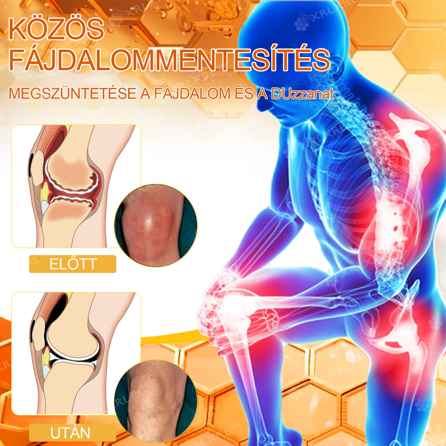 Hivatalos bolt: XRLXRL® Méhméreg Azonnali Ultra Erős Fájdalomcsillapító Krém - (Enyhíti a fájdalmat ízületi gyulladás, izomfájdalom, hátfájás, térdek, hát, vállak, csípők, csuklók, kezek esetén)