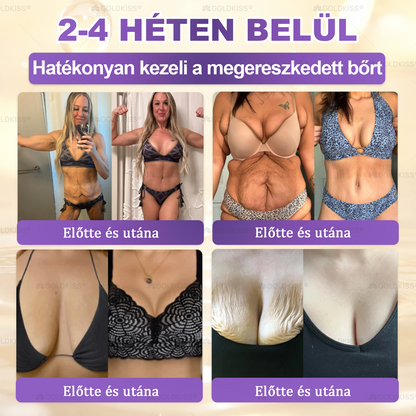 𝐆𝐎𝐋𝐃𝐊𝐈𝐒𝐒® 🎁⏱️ Már csak 5 doboz maradt! További 50% kedvezményt kínálunk! Maradj fitt és egészséges. Ha most veszítesz, jövőre nem kapsz újabb esélyt.