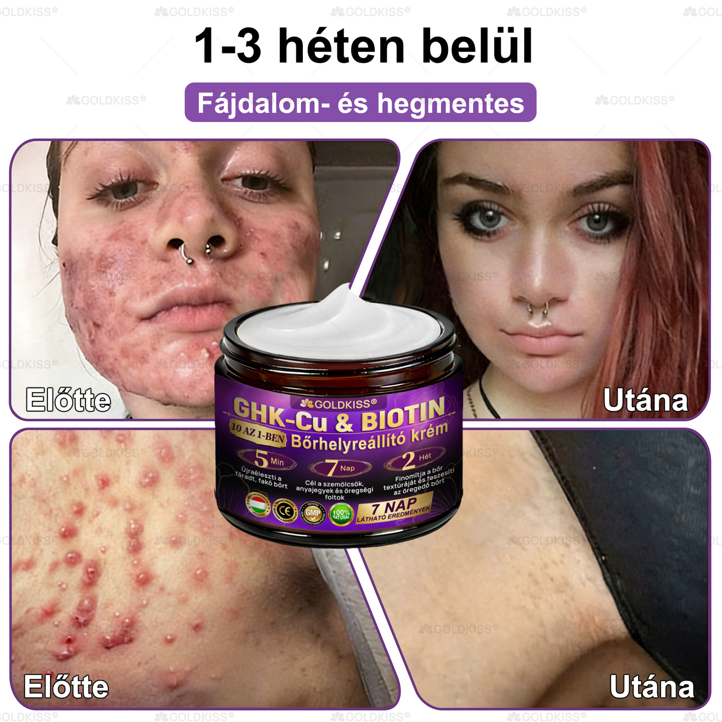 𝐆𝐎𝐋𝐃𝐊𝐈𝐒𝐒® 🎁⏱️ Már csak 5 doboz maradt! További 50% kedvezményt kínálunk! Maradj fitt és egészséges. Ha most veszítesz, jövőre nem kapsz újabb esélyt.