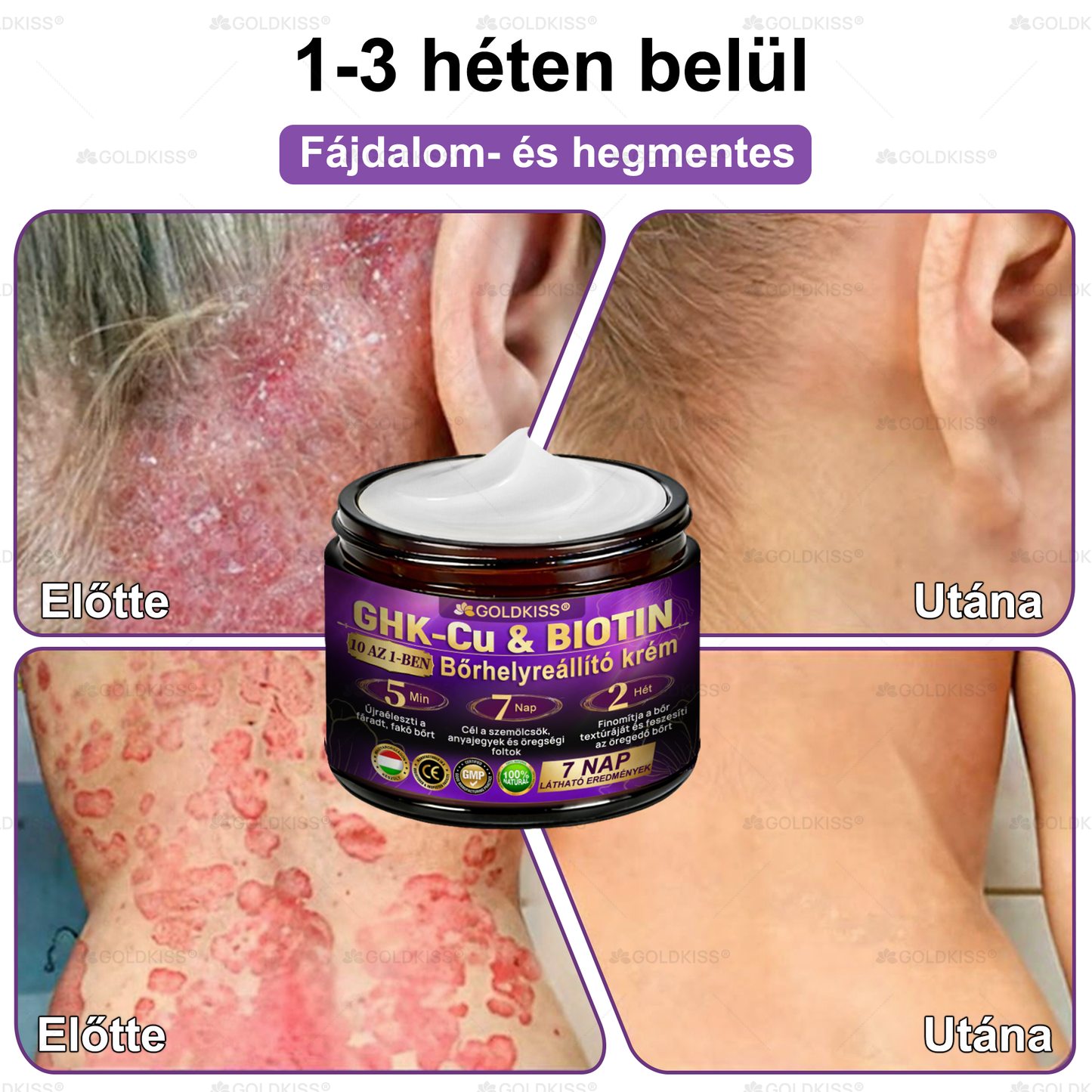 𝐆𝐎𝐋𝐃𝐊𝐈𝐒𝐒® 🎁⏱️ Már csak 5 doboz maradt! További 50% kedvezményt kínálunk! Maradj fitt és egészséges. Ha most veszítesz, jövőre nem kapsz újabb esélyt.