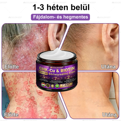 𝐆𝐎𝐋𝐃𝐊𝐈𝐒𝐒® 🎁⏱️ Már csak 5 doboz maradt! További 50% kedvezményt kínálunk! Maradj fitt és egészséges. Ha most veszítesz, jövőre nem kapsz újabb esélyt.
