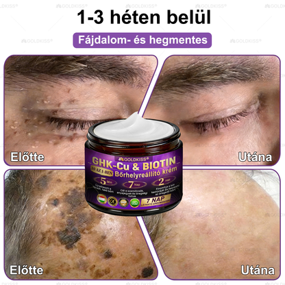 𝐆𝐎𝐋𝐃𝐊𝐈𝐒𝐒® 🎁⏱️ Már csak 5 doboz maradt! További 50% kedvezményt kínálunk! Maradj fitt és egészséges. Ha most veszítesz, jövőre nem kapsz újabb esélyt.