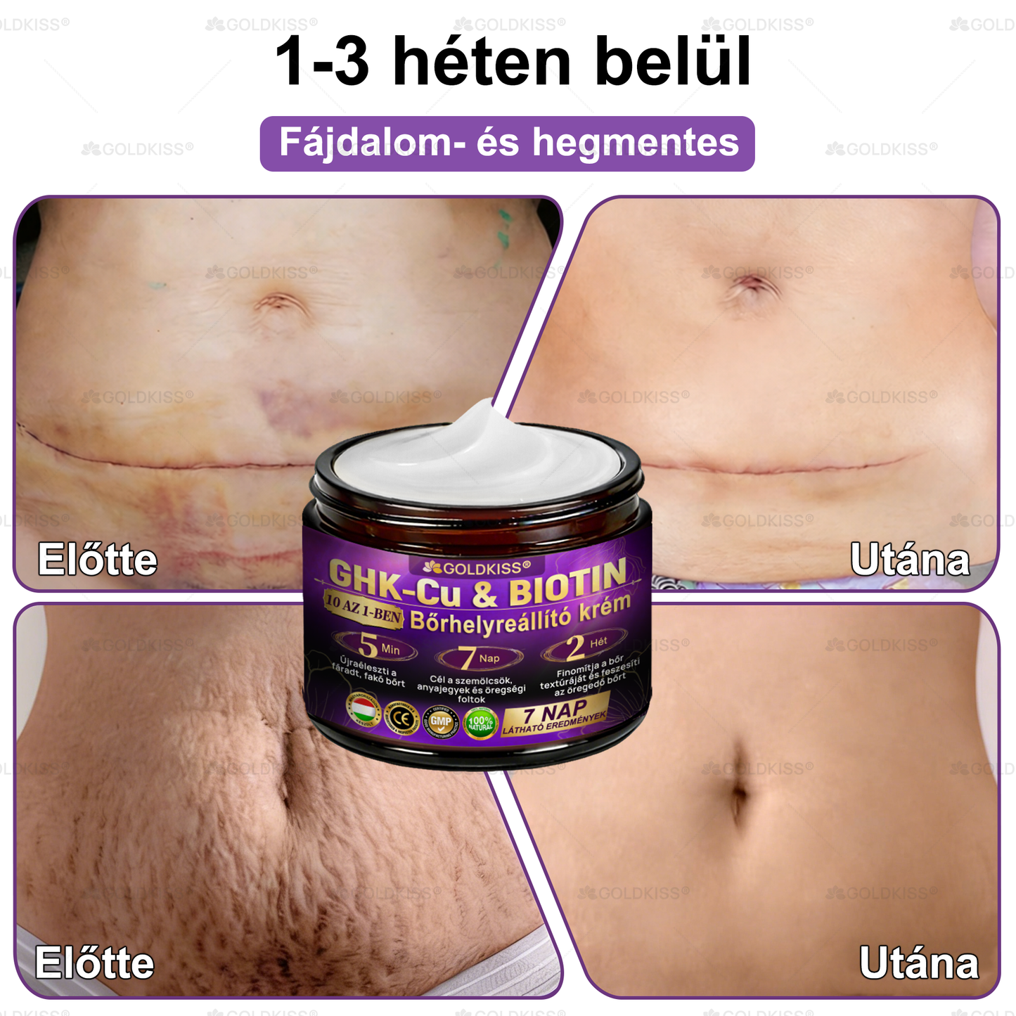 𝐆𝐎𝐋𝐃𝐊𝐈𝐒𝐒® 🎁⏱️ Már csak 5 doboz maradt! További 50% kedvezményt kínálunk! Maradj fitt és egészséges. Ha most veszítesz, jövőre nem kapsz újabb esélyt.
