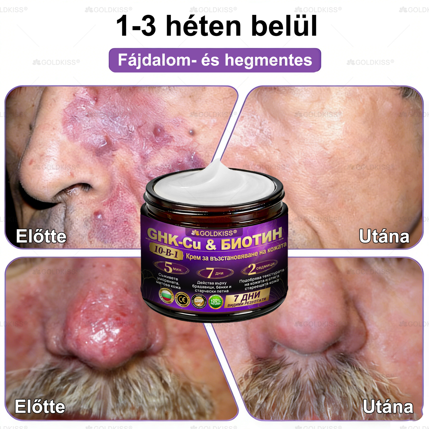 𝐆𝐎𝐋𝐃𝐊𝐈𝐒𝐒® 🎁⏱️ Már csak 5 doboz maradt! További 50% kedvezményt kínálunk! Maradj fitt és egészséges. Ha most veszítesz, jövőre nem kapsz újabb esélyt.